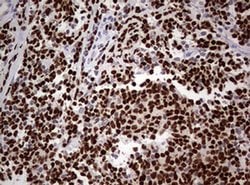 PAX5 Monoclonal Antibody (OTI5A6), TrueMAB , OriGene:Antibodies:Primary