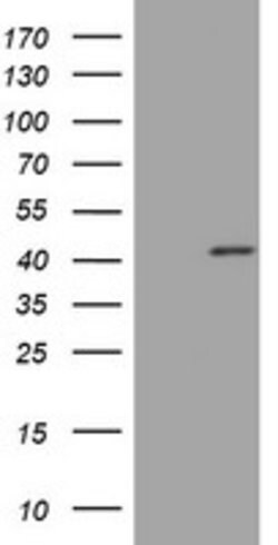 PAX5 Mouse anti-Human, Clone: OTI3A7, lyophilized, TrueMAB 100 &mu;g; Unconjugated:Antibodies,