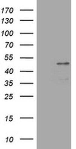 PAX5 Monoclonal Antibody (OTI4F9), TrueMAB , OriGene 100 &mu;L; Unconjugated:Antibodies,