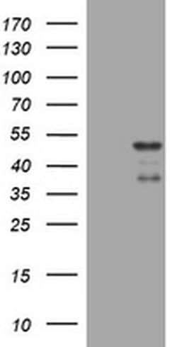 PAX5 Monoclonal Antibody (OTI5A6), TrueMAB , OriGene:Antibodies:Primary