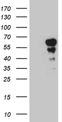 PAX7 Monoclonal Antibody (OTI4A7), TrueMAB , OriGene 30 &mu;L; Unconjugated:Antibodies,