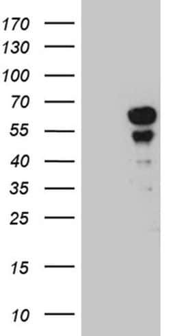 PAX7 Monoclonal Antibody (OTI4G5), TrueMAB , OriGene 100 &mu;L; Unconjugated:Antibodies,