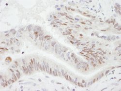 PGC-1 IHC, Polyclonal, Bethyl Laboratories 100 &mu;L; Unconjugated:Antibodies,