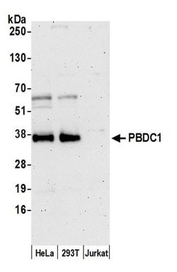PBDC1 Polyclonal Antibody, Bethyl Laboratories 20 &mu;L; Unconjugated:Antibodies,
