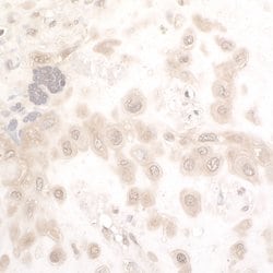 NAMPT/PBEF/Visfatin Rabbit anti-Human, Mouse, Polyclonal, Bethyl Laboratories