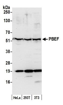NAMPT/PBEF/Visfatin Rabbit anti-Human, Mouse, Polyclonal, Bethyl Laboratories