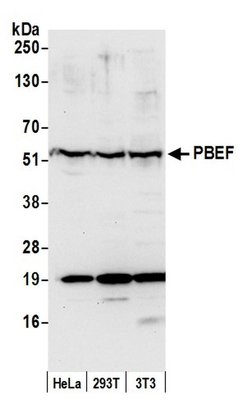 NAMPT/PBEF/Visfatin Polyclonal Antibody, Bethyl Laboratories 20 &mu;L;