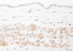 NAMPT/PBEF/Visfatin Polyclonal Antibody, Bethyl Laboratories 10 &mu;L;