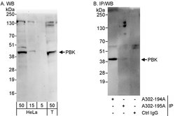 PBK Rabbit anti-Human, Polyclonal, Bethyl Laboratories 100 &mu;L; Unconjugated:Antibodies,