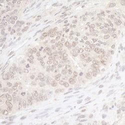 PBRM1 Rabbit anti-Human, Mouse, Polyclonal, Bethyl Laboratories 100 &mu;L;