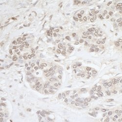 PBRM1 Rabbit anti-Human, Mouse, Polyclonal, Bethyl Laboratories 100 &mu;L;