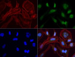PBX1 Mouse anti-Human, Clone: UMAB111, lyophilized, UltraMAB 100 &mu;g;