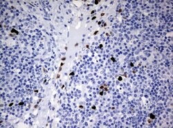PBX1 Mouse anti-Human, Clone: UMAB111, lyophilized, UltraMAB 100 &mu;g;