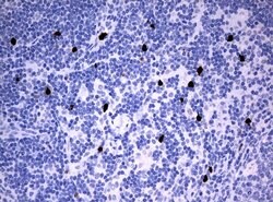 PBX1 Mouse anti-Human, Clone: UMAB111, lyophilized, UltraMAB 100 &mu;g;