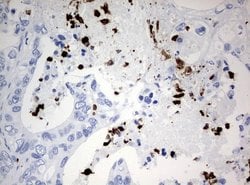 PBX1 Mouse anti-Human, Clone: UMAB111, lyophilized, UltraMAB 100 &mu;g;