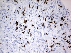 PBX1 Mouse anti-Human, Clone: UMAB111, lyophilized, UltraMAB 100 &mu;g;
