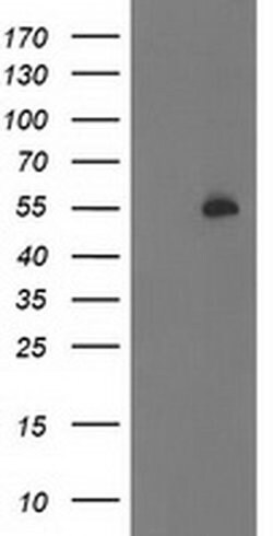 PBX1 Mouse anti-Human, Clone: OTI1D9, liquid, TrueMAB 30 &mu;L; Unconjugated:Antibodies,