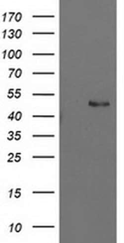 PBX1 Mouse anti-Human, Clone: OTI1C11, liquid, TrueMAB 100 &mu;L; Unconjugated:Antibodies,