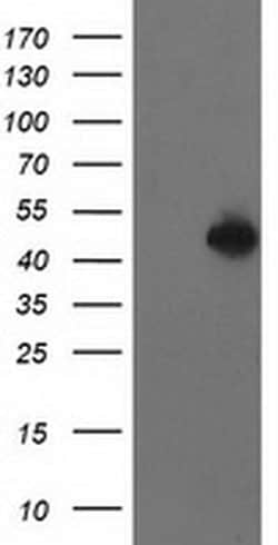 PBX1 Monoclonal Antibody (OTI4D1), TrueMAB , OriGene:Antibodies:Primary