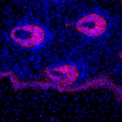 Invitrogen P-cadherin Monoclonal Antibody (12H6) 100 &mu;g; Unconjugated:Antibodies,
