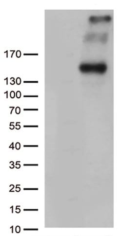 PCDH15 Mouse anti-Human, Clone: OTI7F10, lyophilized, TrueMAB 100 &mu;g;