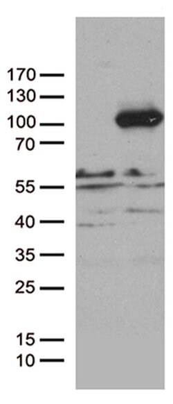 PCDHB8 Monoclonal Antibody (OTI1F6), TrueMAB , OriGene 100 &mu;L; Unconjugated:Antibodies,