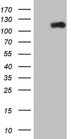 PCDHGC5 Mouse anti-Human, Clone: OTI1G6, lyophilized, TrueMAB 100 &mu;g;