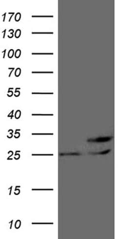 PCMT1 Monoclonal Antibody (OTI2E7), TrueMAB , OriGene 100 &mu;L; Unconjugated:Antibodies,