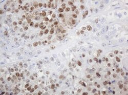 PCNA Monoclonal Antibody (OTI4G3), TrueMAB , OriGene 100 &mu;L; Unconjugated:Antibodies,