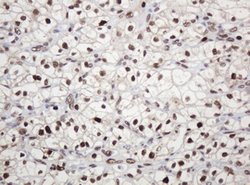 PCNA Mouse anti-Human, Clone: OTI4G3, lyophilized, TrueMAB 100 &mu;g; Unconjugated:Antibodies,
