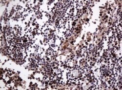 PCNA Mouse anti-Human, Clone: OTI3D6, lyophilized, TrueMAB 100 &mu;g; Unconjugated:Antibodies,