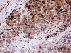 PCNA Mouse anti-Human, Clone: OTI3D6, lyophilized, TrueMAB 100 &mu;g; Unconjugated:Antibodies,