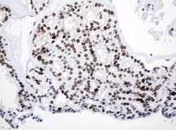 PCNA Monoclonal Antibody (OTI1H10), TrueMAB , OriGene 100 &mu;L; Unconjugated:Antibodies,