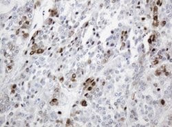 PCNA Monoclonal Antibody (OTI1H10), TrueMAB , OriGene 100 &mu;L; Unconjugated:Antibodies,