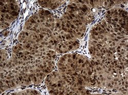 PCNA Monoclonal Antibody (OTI4E3), TrueMAB , OriGene:Antibodies:Primary