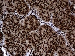 PCNA Monoclonal Antibody (OTI6A10), TrueMAB , OriGene 100 &mu;L; Unconjugated:Antibodies,