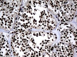 PCNA Monoclonal Antibody (OTI6A10), TrueMAB , OriGene 100 &mu;L; Unconjugated:Antibodies,