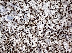 PCNA Monoclonal Antibody (OTI6A10), TrueMAB , OriGene 100 &mu;L; Unconjugated:Antibodies,