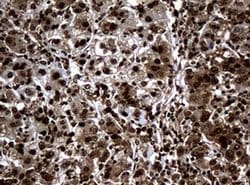 PCNA Monoclonal Antibody (OTI6A10), TrueMAB , OriGene:Antibodies:Primary