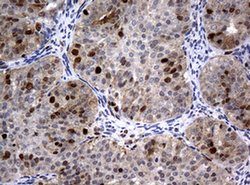 PCNA Monoclonal Antibody (OTI6B6), TrueMAB , OriGene 100 &mu;L; Unconjugated:Antibodies,