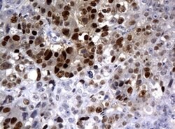 PCNA Monoclonal Antibody (OTI6B6), TrueMAB , OriGene 100 &mu;L; Unconjugated:Antibodies,