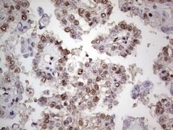 PCNA Monoclonal Antibody (OTI13G4), TrueMAB , OriGene 100 &mu;L; Unconjugated:Antibodies,