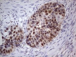 PCNA Monoclonal Antibody (OTI13G4), TrueMAB , OriGene 100 &mu;L; Unconjugated:Antibodies,