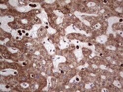 PCNA Monoclonal Antibody (OTI13G4), TrueMAB , OriGene:Antibodies:Primary