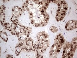 PCNA Monoclonal Antibody (OTI13G4), TrueMAB , OriGene 100 &mu;L; Unconjugated:Antibodies,