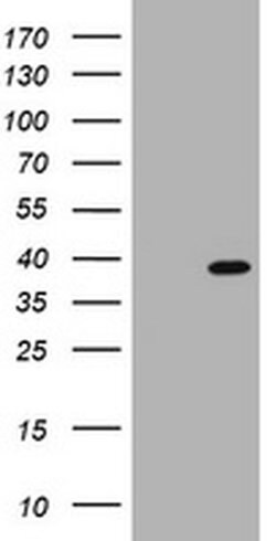 PCNA Monoclonal Antibody (OTI5F9), TrueMAB , OriGene 100 &mu;L; Unconjugated:Antibodies,