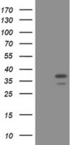 PCNA Mouse anti-Human, Clone: OTI3D6, lyophilized, TrueMAB 100 &mu;g; Unconjugated:Antibodies,
