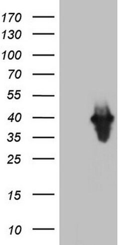 PCNA Monoclonal Antibody (OTI13G4), TrueMAB , OriGene 100 &mu;L; Unconjugated:Antibodies,