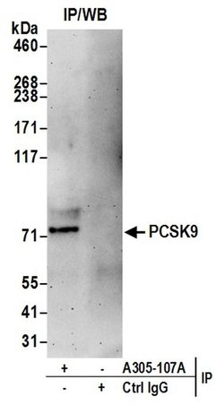 PCSK9 Rabbit anti-Human, Polyclonal, Bethyl Laboratories 100 &mu;l; Unlabeled:Antibodies,