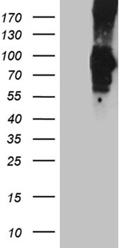 PCSK9 Monoclonal Antibody (OTI8C12), TrueMAB , OriGene 100 &mu;L; Unconjugated:Antibodies,